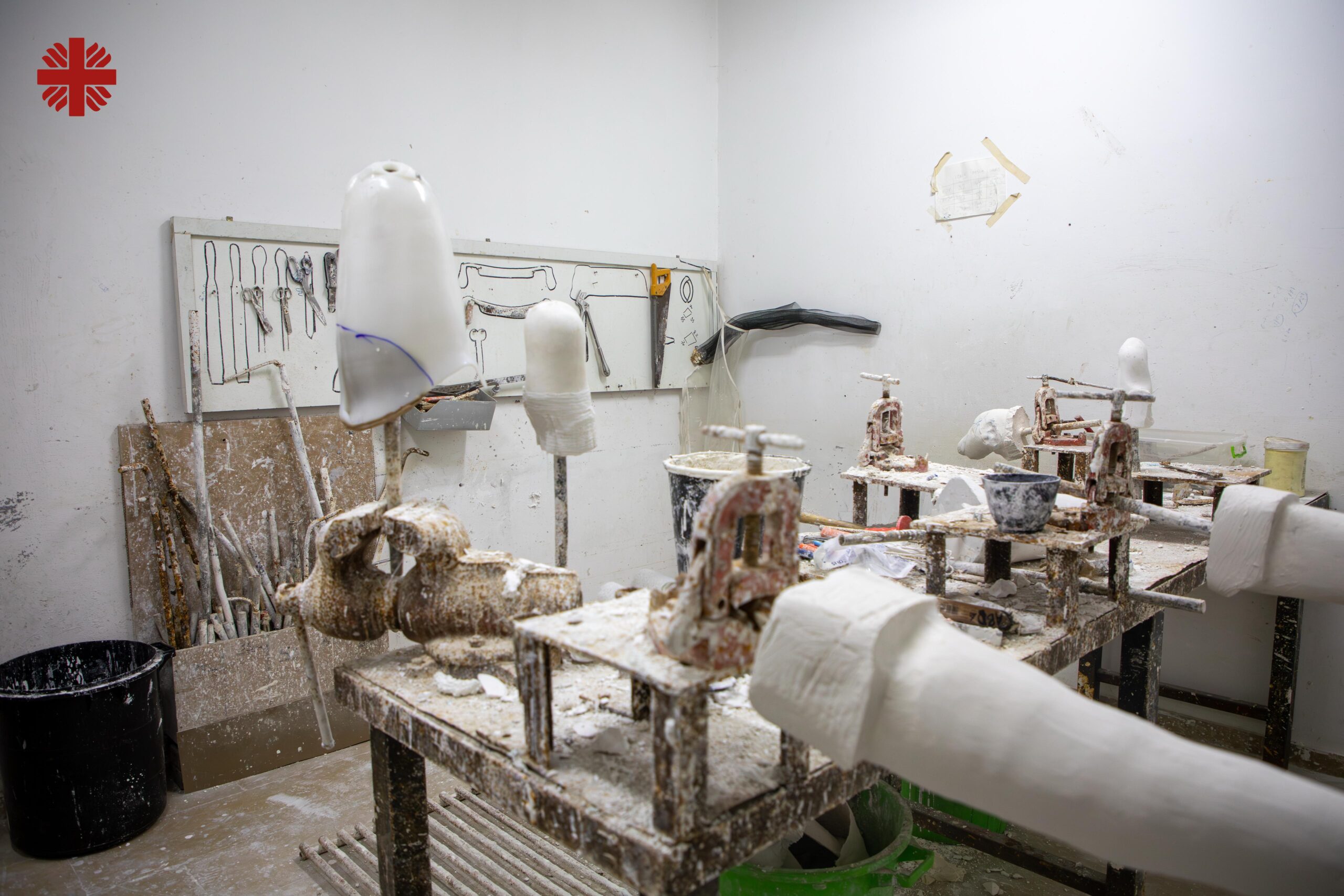 Protheses In Various Stages Of Production Photo Credit Caritas Jerusalem