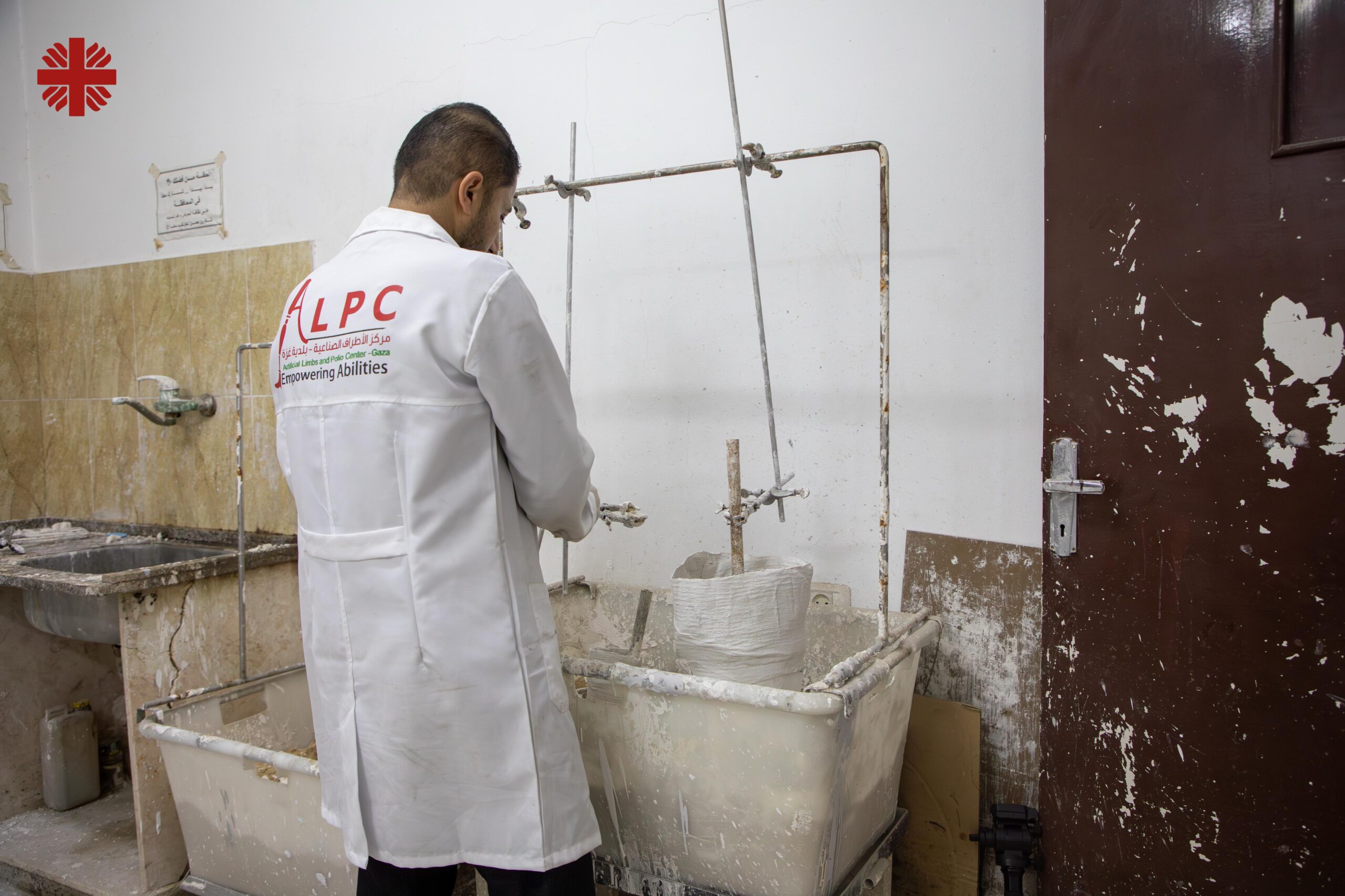 A Specialist Works On Casting A Prosthetic Photo Credit Caritas Jerusalem